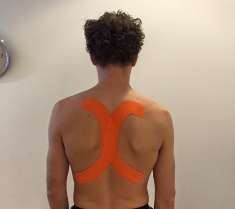 Het hooikoortsseizoen is weer begonnen! Tapen kan uitkomst bieden! 